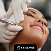 Translation missing: es.sections.featured_product.gallery_thumbnail_alt