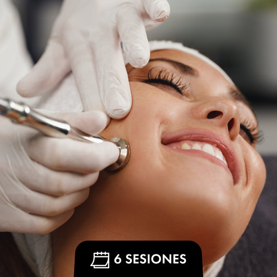 Paquete Microdermoabrasión (6 sesiones)