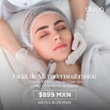 Translation missing: es.sections.featured_product.gallery_thumbnail_alt
